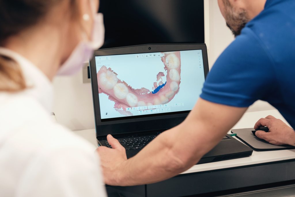 scanare intraorala laborator